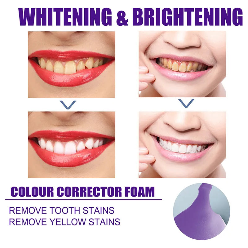 Teeth Whitening & Cleaning Toothpaste